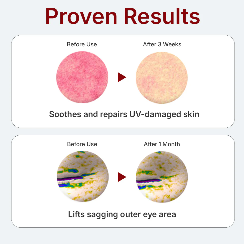 Madeca derma mask III Intensive Formula 23ml*10p - Image 3