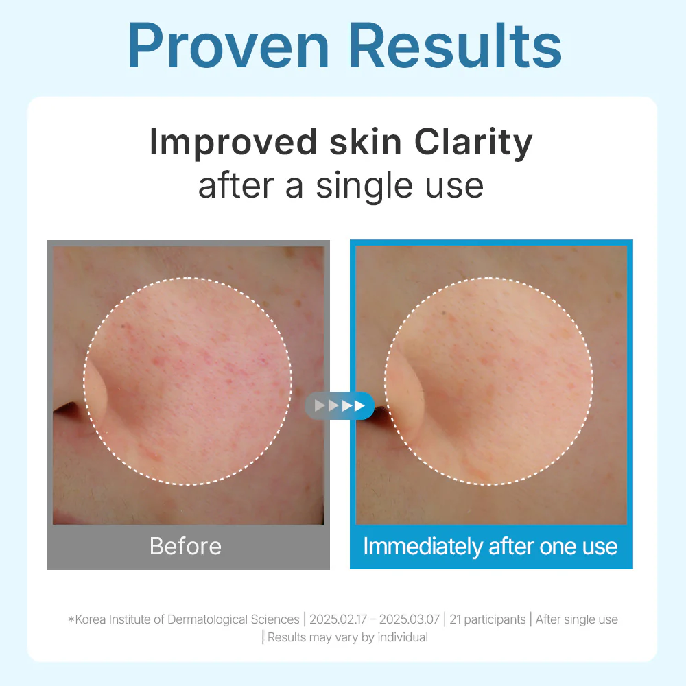 Madeca Lab Hyal Waterfull Glow Gel Mask 1ea - Image 3